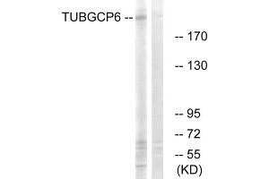 Western blot analysis of extracts from COLO cells, using TUBGCP6 antibody. (GCP6 antibody  (Internal Region))