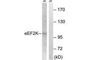 Western blot analysis of extracts from Jurkat cells, using eEF2K (Ab-359) Antibody. (EEF2K antibody  (AA 336-385))