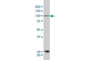 ARTS-1 monoclonal antibody (M01), clone 4H8 Western Blot analysis of ARTS-1 expression in A-431 . (ERAP1 antibody  (AA 832-941))