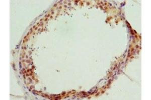 Immunohistochemistry of paraffin-embedded human testis tissue using ABIN7153413 at dilution of 1:100 (GABPB1 antibody  (AA 231-395))