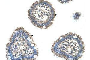 Image no. 1 for anti-Ubiquitin-Conjugating Enzyme E2L 3 (UBE2L3) (C-Term) antibody (ABIN203476) (UBE2L3 antibody  (C-Term))