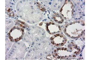 Immunohistochemical staining of paraffin-embedded Human Kidney tissue using anti-BECN1 mouse monoclonal antibody. (Beclin 1 antibody)