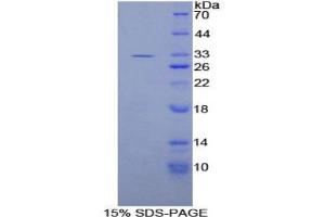 SDS-PAGE analysis of Human IL20Rb Protein. (IL20RB Protein)