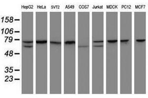 Image no. 2 for anti-Coiled-Coil Domain Containing 93 (CCDC93) (AA 293-631) antibody (ABIN1491350) (CCDC93 antibody  (AA 293-631))