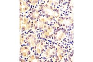 (ABIN6242334 and ABIN6578174) staining FN3KRP in human Stomach sections by Immunohistochemistry (IHC-P - paraformaldehyde-fixed, paraffin-embedded sections). (FN3KRP antibody  (AA 24-58))