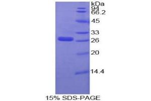 SDS-PAGE of Protein Standard from the Kit (Highly purified E. (IGFBP4 CLIA Kit)