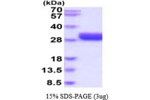 SDS-PAGE (SDS) image for Oxidized Low Density Lipoprotein (Lectin-Like) Receptor 1 (OLR1) (AA 58-273) protein (His tag) (ABIN5854750)