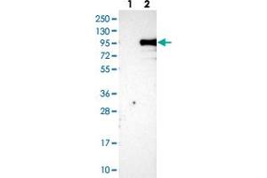 Western blot analysis of Lane 1: Negative control (vector only transfected HEK293T lysate), Lane 2: Over-expression Lysate (Co-expressed with a C-terminal myc-DDK tag (~3. (KIAA1586 antibody)
