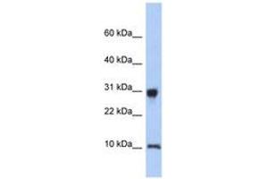 Image no. 1 for anti-Ribosomal Protein S21 (RPS21) (N-Term) antibody (ABIN6744006) (RPS21 antibody  (N-Term))