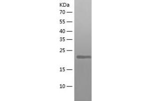 Western Blotting (WB) image for D-Tyrosyl-tRNA Deacylase 1 Homolog (S. Cerevisiae) (DTD1) (AA 1-209) protein (His tag) (ABIN7288037) (DTD1 Protein (AA 1-209) (His tag))