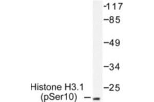 Image no. 1 for anti-Histone H3.1 (HIST1H3B) (pSer10) antibody (ABIN318041) (Histone H3.1 antibody  (pSer10))