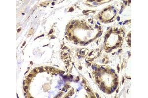 Immunohistochemistry of paraffin-embedded Human breast using HDAC4 Polyclonal Antibody at dilution of 1:100 (40x lens). (HDAC4 antibody)