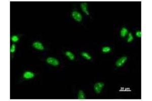 Immunostaining analysis in HeLa cells. (ZSCAN21 antibody)
