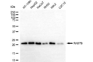 anti-RAB7B, Member RAS Oncogene Family (RAB7B) antibody