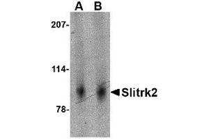 Image no. 1 for anti-SLIT and NTRK-Like Family, Member 2 (SLITRK2) (Internal Region) antibody (ABIN1493816) (SLITRK2 antibody  (Internal Region))