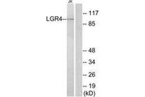 Western blot analysis of extracts from Jurkat cells, using LGR4 Antibody. (LGR4 antibody  (AA 461-510))