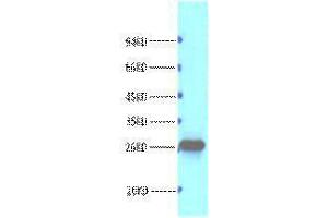 Western Blotting (WB) image for anti-B-Cell CLL/lymphoma 2 (BCL2) antibody (ABIN3178594) (Bcl-2 antibody)