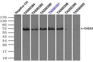 Image no. 1 for anti-Checkpoint Kinase 2 (CHEK2) antibody (ABIN1497499) (CHEK2 antibody)