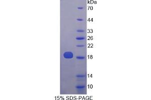 Image no. 1 for Phospholipase A2, Group X (PLA2G10) (AA 32-165) protein (His tag) (ABIN4990040) (PLA2G10 Protein (AA 32-165) (His tag))