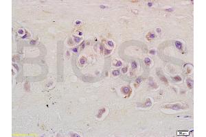 Formalin-fixed and paraffin embedded human placenta tissue labeled with Anti-CSIG Polyclonal Antibody, Unconjugated (ABIN728248) at 1:200 followed by conjugation to the secondary antibody and DAB staining (RSL1D1 antibody  (AA 151-250))