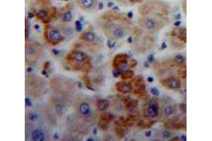 Used in DAB staining on fromalin fixed paraffin-embedded Liver tissue (IGLL1 antibody  (AA 112-206))