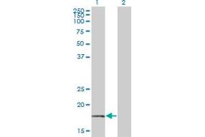Western Blot analysis of BTF3 expression in transfected 293T cell line by BTF3 monoclonal antibody (M01), clone 3C4-2E11.