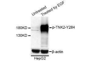 Western blot analysis of extracts of HepG2 cells, using Phospho-TNK2-Y284 antibody (ABIN5995622) at 1/1000 dilution. (TNK2 antibody  (pTyr284))