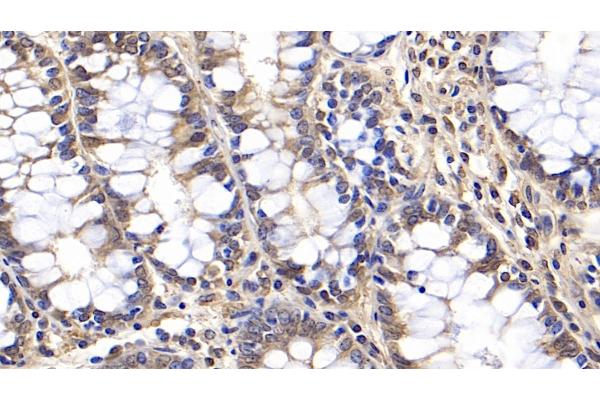 OAS2 antibody  (AA 11-346)