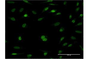 Immunofluorescence of monoclonal antibody to RFC5 on HeLa cell. (RFC5 antibody  (AA 1-340))