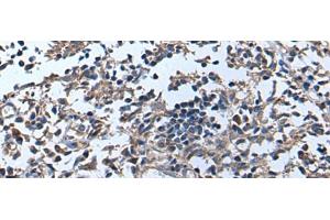 Immunohistochemistry of paraffin-embedded Human tonsil tissue using APOD Polyclonal Antibody at dilution of 1:55(x200) (Apolipoprotein D antibody)
