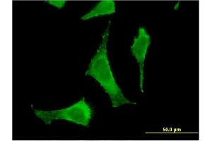 Immunofluorescence of monoclonal antibody to PGLS on HeLa cell. (PGLS antibody  (AA 1-258))