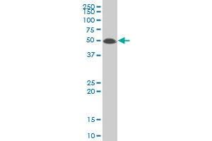 CDC42EP1 polyclonal antibody (A01), Lot # 051102JC01 Western Blot analysis of CDC42EP1 expression in MES-SA/Dx5 . (CDC42EP1 antibody  (AA 1-384))