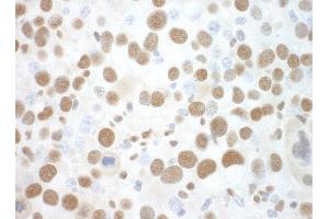 Immunohistochemistry (IHC) image for anti-Splicing Factor 3b, Subunit 3, 130kDa (SF3B3) (AA 1167-1217) antibody (ABIN7448792)