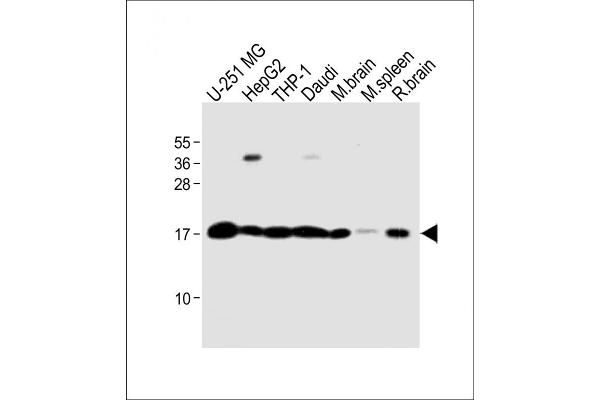 RPS18 antibody  (AA 62-91)