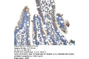 Human Intestine (SLC25A39 antibody  (C-Term))