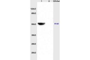 Lane 1: mouse heart lysates Lane 2: mouse brain lysates probed with Anti IDH2 Polyclonal Antibody, Unconjugated (ABIN751558) at 1:200 in 4 °C.