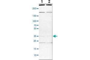 Western blot analysis of cell lysates with SYF2 polyclonal antibody .