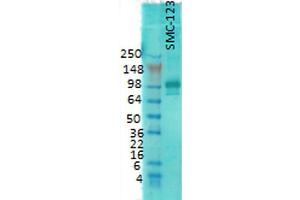 Western Blot analysis of Rat brain membrane lysate showing detection of PSD95 protein using Mouse Anti-PSD95 Monoclonal Antibody, Clone 7E3 . (DLG4 antibody  (Biotin))