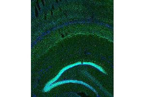 Indirect immunostaining of PFA fixed mouse brain section (dilution 1 : 200; green). (BCL11B antibody)