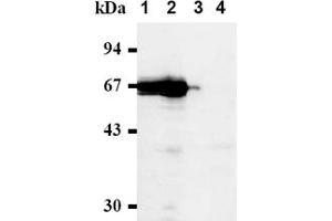 Western Blotting (WB) image for anti-Cell Division Cycle 7 (CDC7) antibody (ABIN487481) (CDC7 antibody)