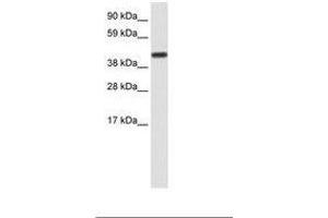 Image no. 1 for anti-CCR4-NOT Transcription Complex, Subunit 2 (CNOT2) (AA 112-161) antibody (ABIN202350) (CNOT2 antibody  (AA 112-161))