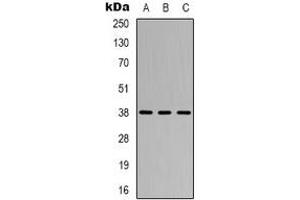 Western blot analysis of CYSLTR1 expression in Jurkat (A), HUVEC (B), COS7 (C) whole cell lysates.
