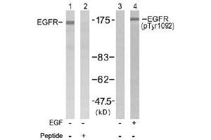 Image no. 2 for anti-Epidermal Growth Factor Receptor (EGFR) (Tyr1092) antibody (ABIN197231) (EGFR antibody  (Tyr1092))