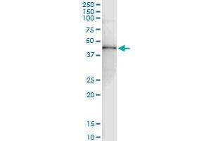 Immunoprecipitation of RRM2 transfected lysate using anti-RRM2 MaxPab rabbit polyclonal antibody and Protein A Magnetic Bead , and immunoblotted with RRM2 purified MaxPab mouse polyclonal antibody (B01P) . (RRM2 antibody  (AA 1-389))