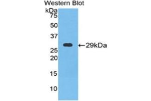 Western Blotting (WB) image for anti-Neuronal Pentraxin 1 (NPX1) (AA 146-384) antibody (ABIN1860045)