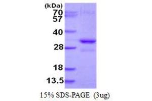 Image no. 1 for Vacuolar-sorting Protein SNF8 (SNF8) protein (His tag) (ABIN1098312) (SNF8 Protein (His tag))