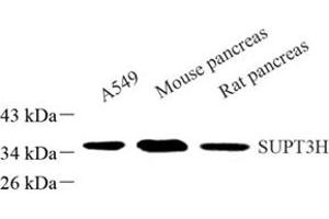 Western blot analysis of SUPT3H (ABIN7075767) at dilution of 1: 500 (SUPT3H/SPT3 antibody)