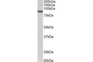 ABIN870677 (1µg/ml) staining of A549 lysate (35µg protein in RIPA buffer). (FGFR1 antibody  (Internal Region))