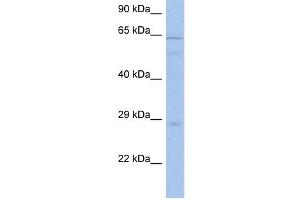 PRKAA1 antibody used at 1 ug/ml to detect target protein. (PRKAA1 antibody  (Middle Region))