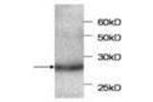 Image no. 1 for anti-serpin Peptidase Inhibitor, Clade B (Ovalbumin), Member 4 (SERPINB4) antibody (ABIN791516)